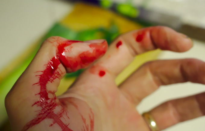 a bleeding hand